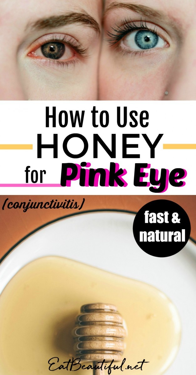 Honey For Pinkeye Conjunctivitis — The Best Home Remedy Eat Beautiful 