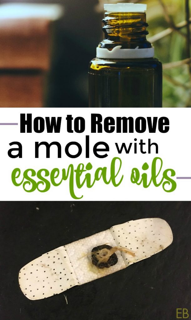 How to Remove Moles and Warts with Essential Oils {with step-by-step method} #moles #moleremoval #essentialoils #EOremedies #howtoremove #herbalremedies