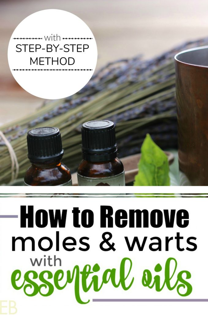 How to Remove Moles and Warts with Essential Oils {with step-by-step method} #wartremoval #moleremoval #essentialoils #EOremedies #howtoremove #herbalremedies