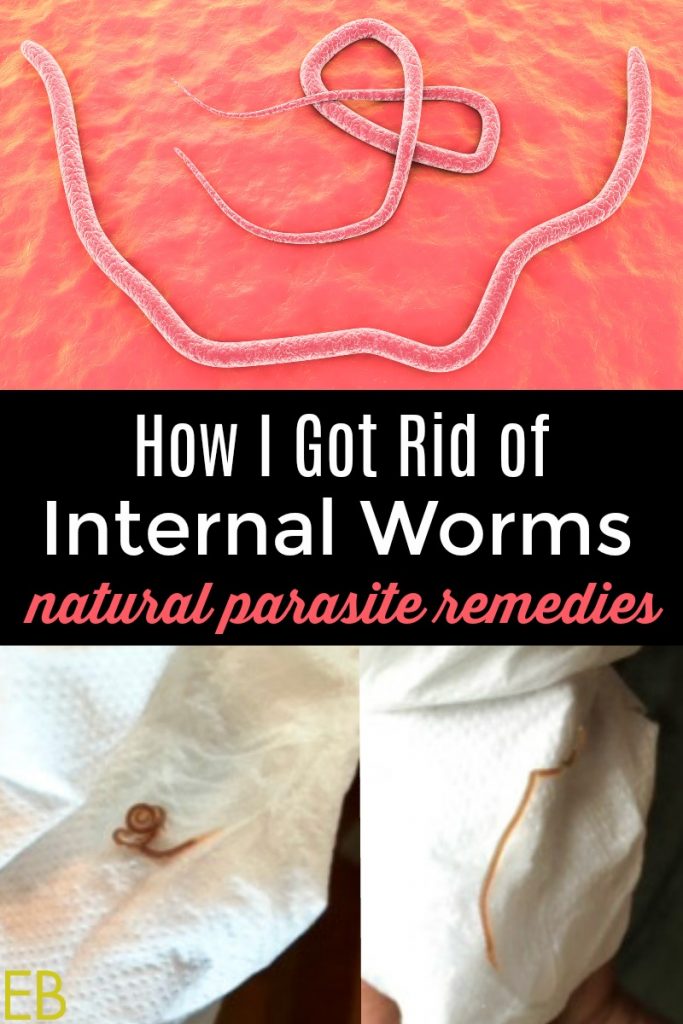 image of ascaris worms and natural parasite remedies banner
