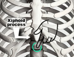 left hand just under xiphoid process point, pointing where to touch